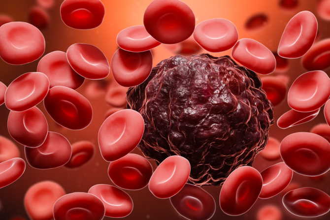 cancerous cells image